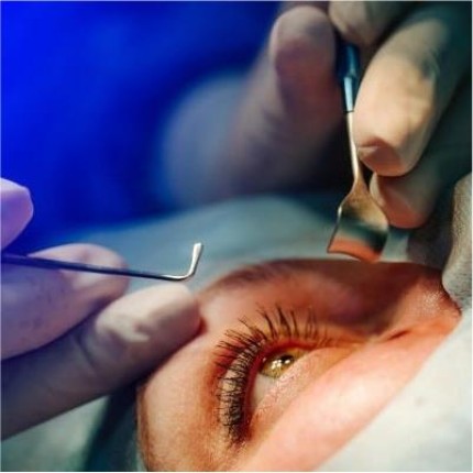 Cirurgia Ocular