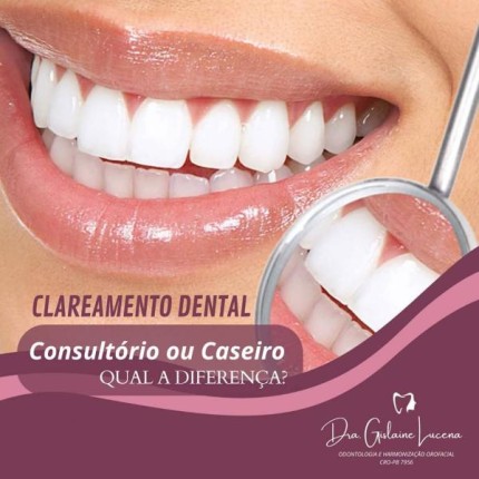 Clareamento Dental