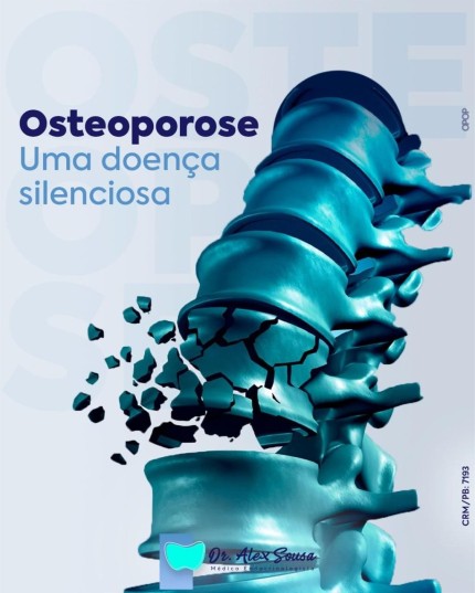 Tratamento para Osteoporose